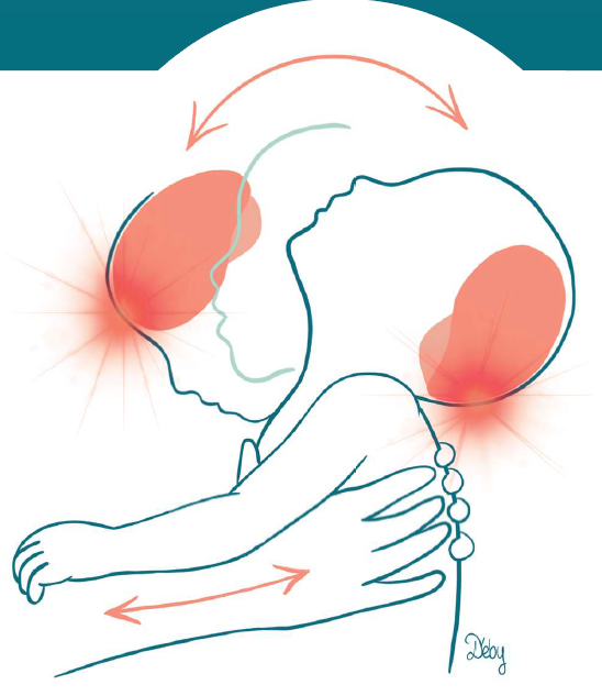 Le Syndrome Du Bebe Secoue Repere Reseau Sante Professionnel Perinatalite Ile De La Reunion